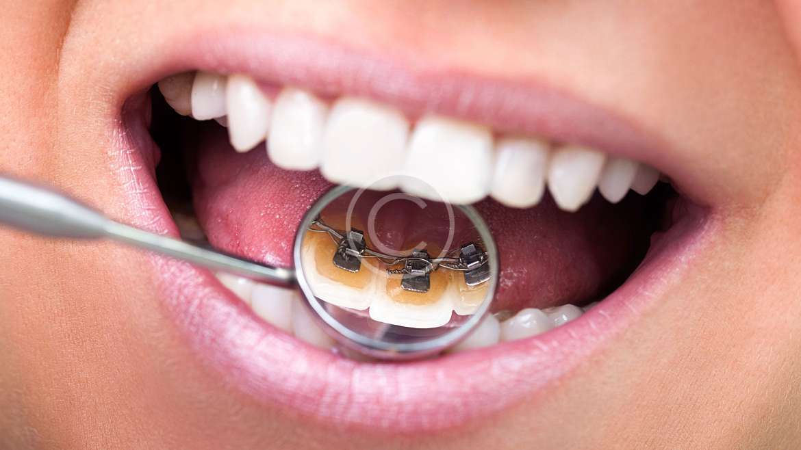 DENTAL SERVICES