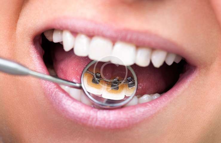 DENTAL SERVICES