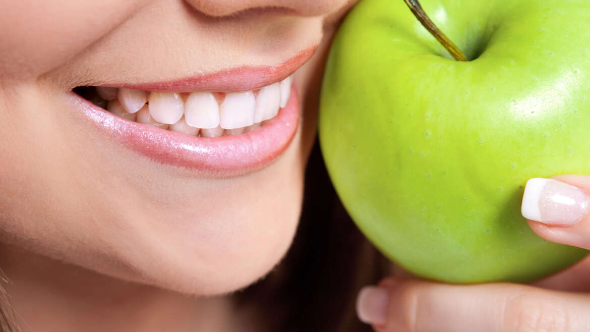 Invisalign