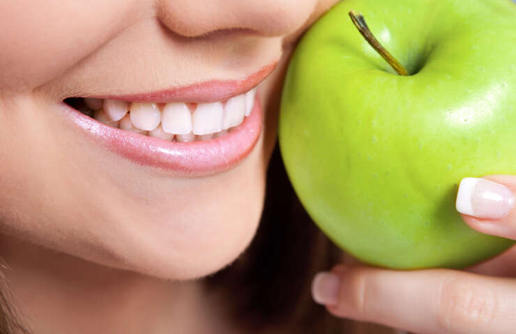 Invisalign