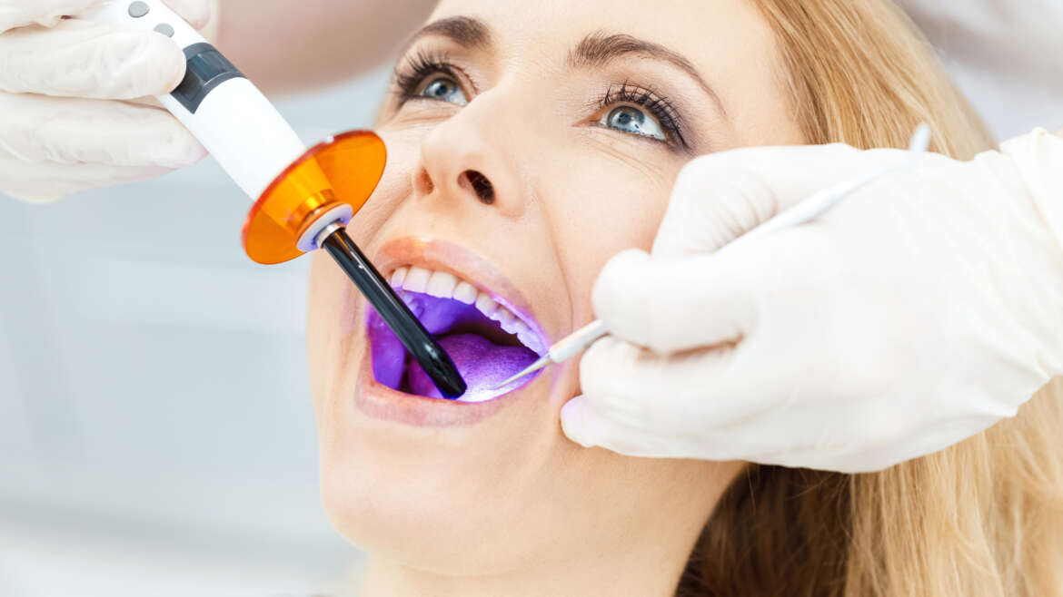 Fillings