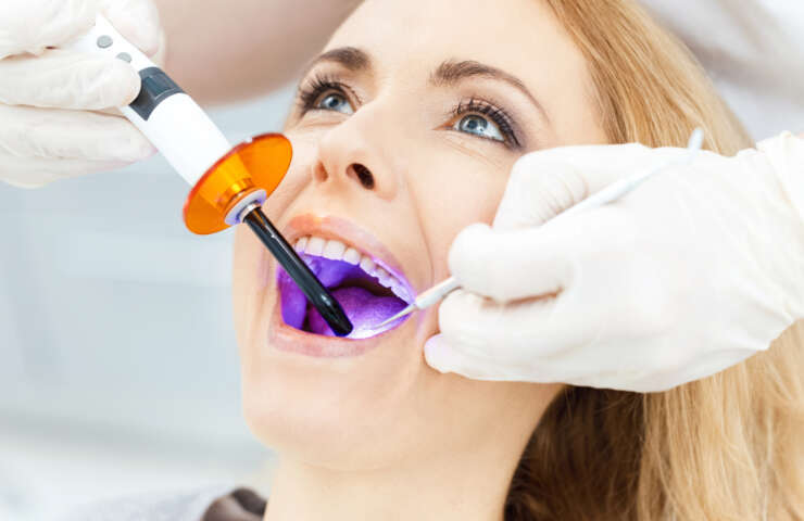 Fillings